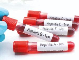 Ferdî eşyada hepatit riski