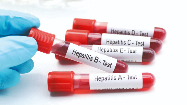 Ferdî eşyada hepatit riski