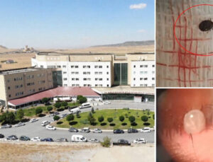 12 yaşındaki çocuğun gözünden çıktı! Bu belirti varsa çabucak hastaneye koşun
