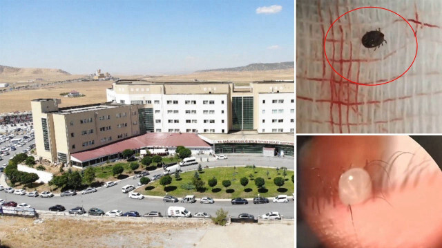 12 yaşındaki çocuğun gözünden çıktı! Bu belirti varsa çabucak hastaneye koşun