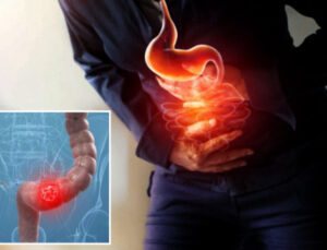 Gastroenteroloji profesörü ’50 yaş’ ayrıntısına dikkat çekip açıkladı: Kanseri yüzde 90 önleyip riski en aza indiriyor