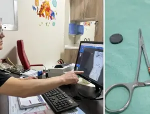 Karaman’da tuvaletini yapamayan çocuğun bağırsağından iki mıknatıs çıkarıldı