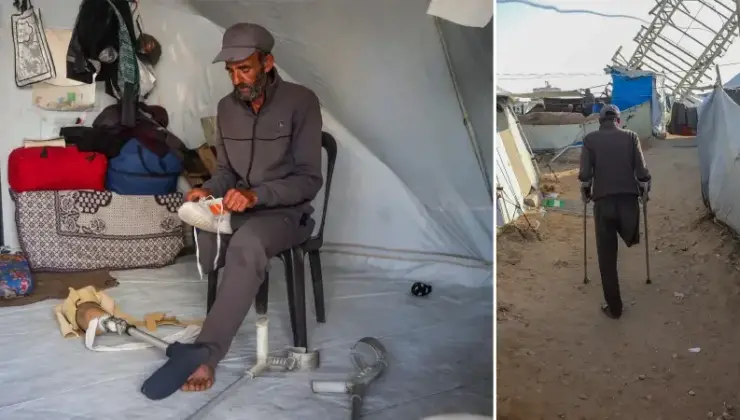 İsrail hücumunda bir bacağını kaybetti: Filistinli pürüzüne karşın yaşama tutunmaya çalışıyor