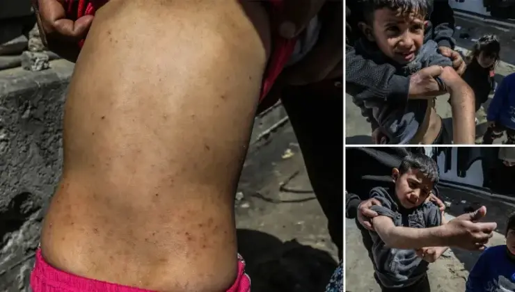 Dünyanın unuttuğu yer ‘Gazze’: Böcekler çocukları yemeye başladı