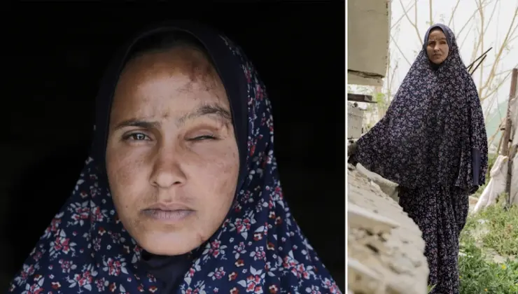 Gazze’de kısmi görme kaybı yaşayan Filistinli genç bayan hayat uğraşı veriyor