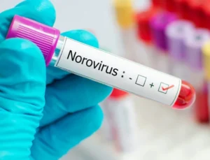 Çocuklarda ani kusma ve ishal norovirüsün habercisi olabilir