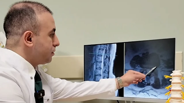 Uzmanından bel fıtığına karşı ihtar: “Ameliyat en son seçenek ancak bu belirtilere dikkat”
