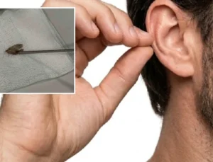 Kulağından canlı olarak çıkarıldı, doktor bile şoke oldu: Hareketliydi, tabiata bıraktık