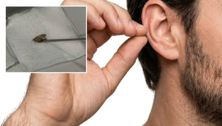 Kulağından canlı olarak çıkarıldı, doktor bile şoke oldu: Hareketliydi, tabiata bıraktık