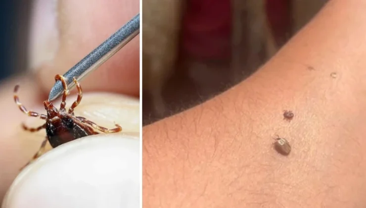 Tokat’ta 10 kişi KKKA hastalığı teşhisiyle tedavi görüyor
